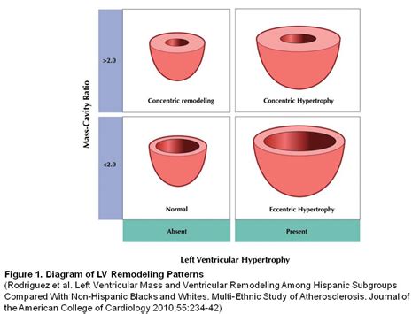 lv shows concentric hypertrophy|concentric remodeling vs hypertrophy.